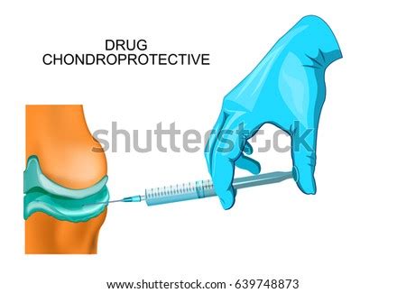 Vector Illustration Puncture Synovitis Knee Joint Immagine Vettoriale