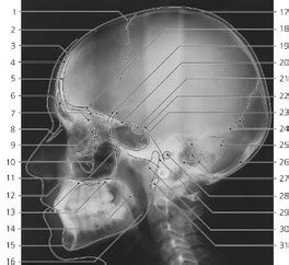 Lateral X-ray Skull Anatomy Diagram | Quizlet