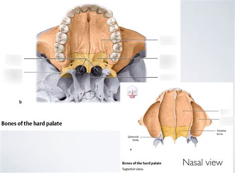 Bones Of The Hard Palate Diagram Quizlet