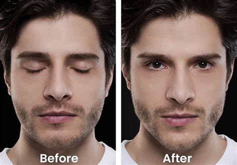 Why an increasing number of men are accentuating their jawline using fillers - Van Lennep Kliniek