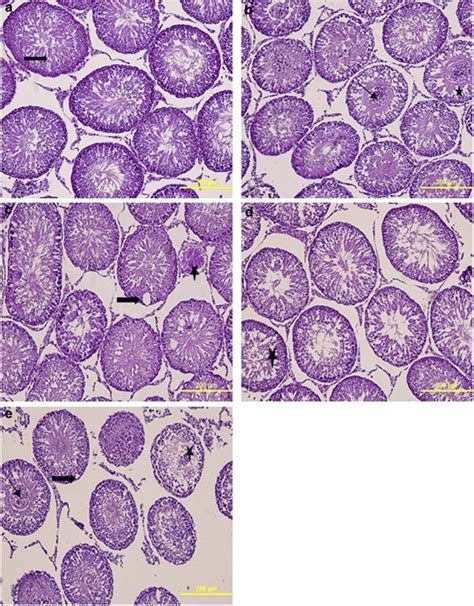 Hematoxylin Eosin Staining Image Of Acute Group Testis Tissue A Normal