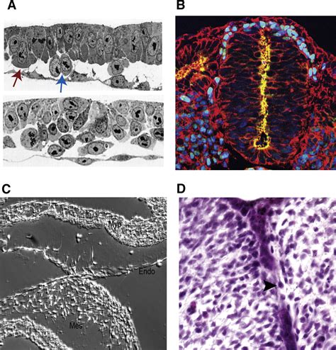 Epithelial Mesenchymal Transition At The Crossroads Of Development And