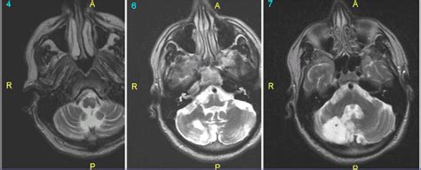 Question 70 MRI Online