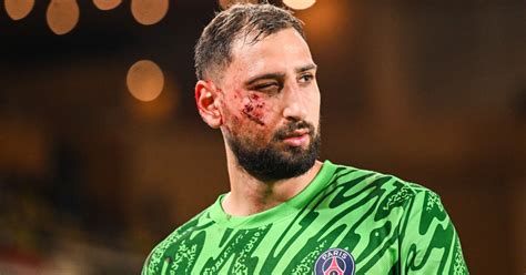 Psg The Club Communicates On Donnarumma S Injury