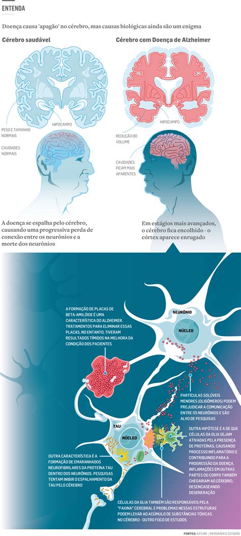 De Bem Com A Vida Saiba Como Identificar O Alzheimer Prevenir E