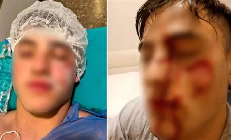 Fue Premeditado Dijo La Madre Del Joven Atacado En Un Boliche De