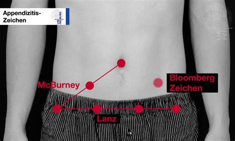 Modul Untersuchung Des Abdomens U Kurs