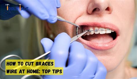 How To Cut Braces Wire At Home Top 9 Easy Steps