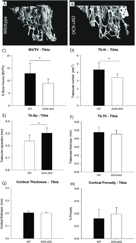 Trabecular Bone Volume Is Decreased In Gata Ocn Cko Mice A B Ct