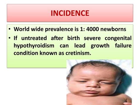 Hypothyroidism in children | PPT