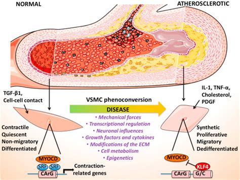 Targeting The Phenotypic Switch Of Vascular Smooth Muscle Cells To