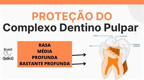 CAPEAMENTO PULPAR DIRETO VS INDIRETO YouTube