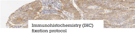 Immunohistochemistry Ihc Fixation Protocol Abcam Protocols