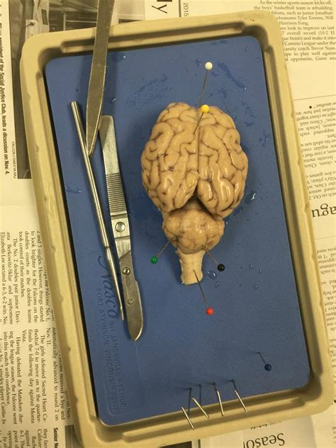 The Best of Anatomy: Brain Dissection Anaylsis