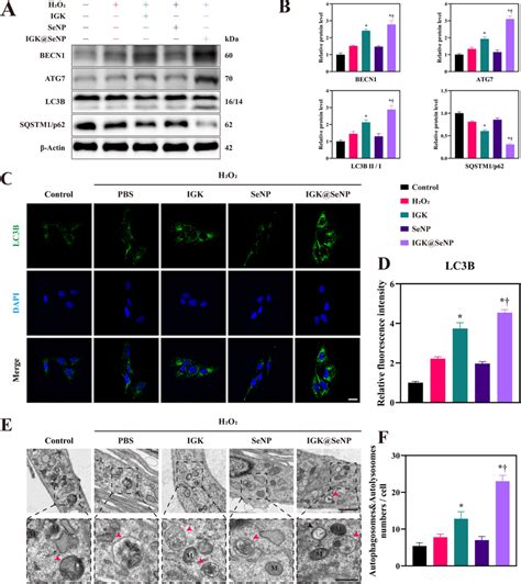 Igksenp Promotes Autophagy In H2o2 Treated Npcs A Western Blotting