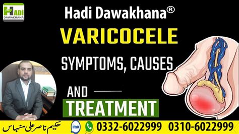 Varicocele Symptoms Causes And Treatment Varicocele Ka Ilaj