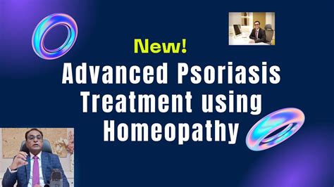 New Advance Psoriasis Treatment Using Homeopathy Youtube