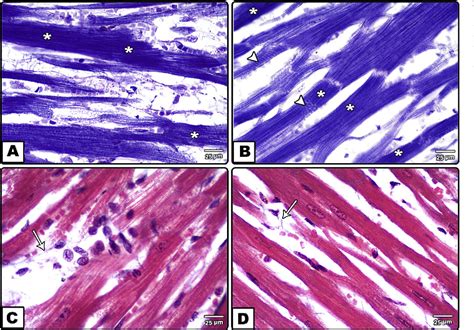 Figure From Histological And Immunohistochemical Study Of Cardiac