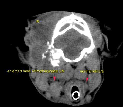 Ct Soft Tissue Infiltrative Neoplasia With Metastases Originating