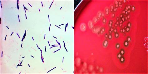 Clostridium perfringens - Medicina Básica