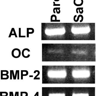 Characterization of SaOS 2 Gsα 2 by RT PCR analyses The Download