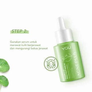 Jual You Acne Plus Cica Herbs Derma Solution Acneplus Toner Spotcare