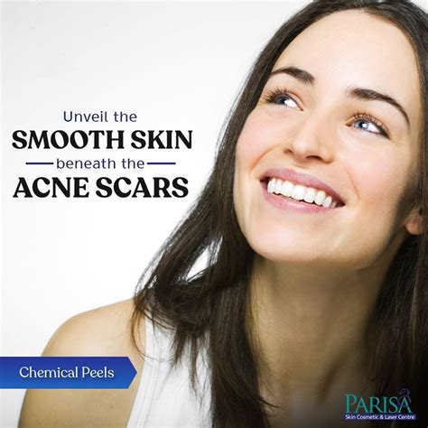 Acne Treatment in Chandigarh. Acne occurs when the sebaceous or oil ...