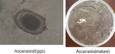 Ascariasis Eggs And Mature Download Scientific Diagram