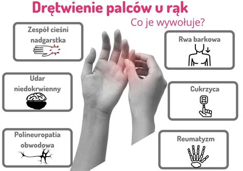 Dr Twienie Palc W U R K Leczenie Sposoby