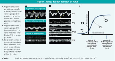 L Cho Cardio Graphie Au Chevet Du Patient En Soins Aigus Journal De