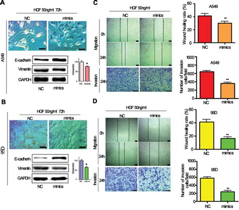 Mir 206 Inhibits Hgf Induced Epithelial Mesenchymal Transition And