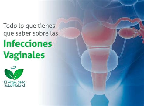 Hay Varios Tipos De Infecciones Vaginales Que Se Contraen Por Hot Sex