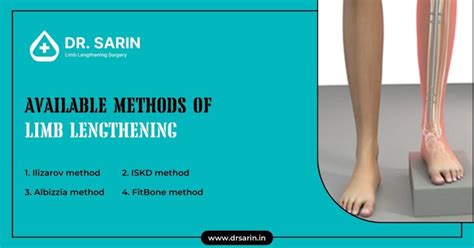 Available Methods Of Limb Lengthening Dr Sarin