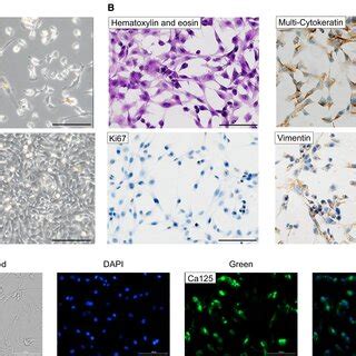 Characterization Of SmallEVs Isolated From Human Ovarian Ascites