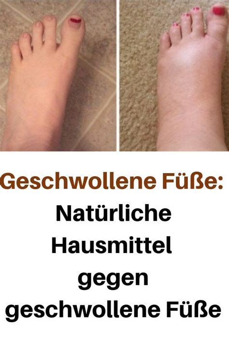 Geschwollene Füße Natürliche Hausmittel gegen geschwollene Füße