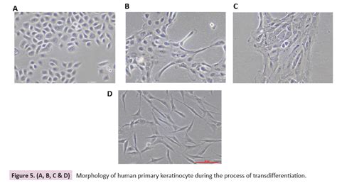 The Trans Differentiation Of Keratinocyte Requisite For Skin Wou