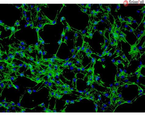 Human Dermal Fibroblasts Adult HDF A