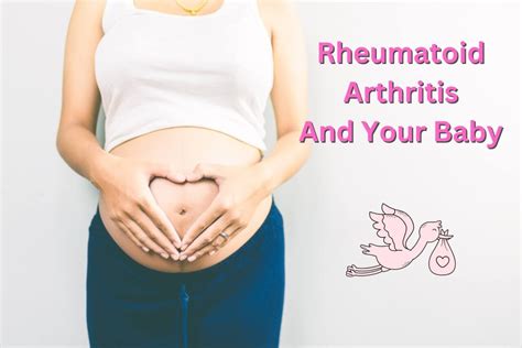 Rheumatoid Arthritis During Pregnancy Arthritis Free Living