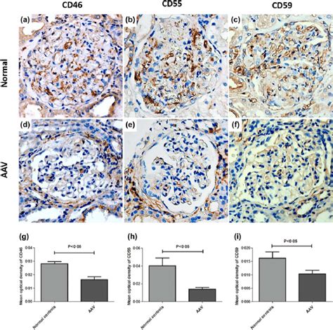 Immunohistochemistry Staining For Cd46 Cd55 And Cd59 In Glomeruli Of