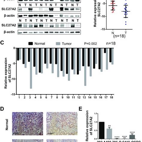 Slc A Was Significantly Downregulated In Ccrcc Tissues And Cell