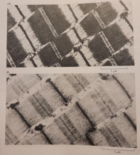 Solved Problem Two Electron Micrographs Of A Myofilament In Chegg