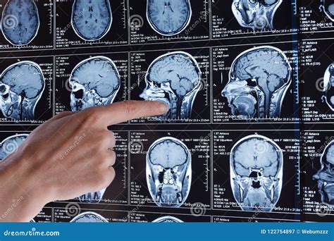 Magnetic Resonance Scan Of The Brain MRI Head Scan Stock Image Image