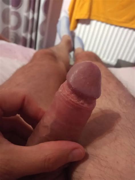 Smegma Cheese Nude Pics Xhamster