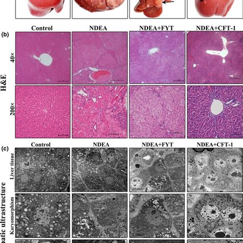 Liver Tissue Hande Staining And Hepatocyte Ultrastructure Of Livers In Download Scientific