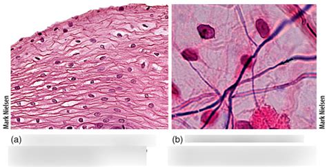 Comparison Of Epithelial Vs Connective Tissue Diagram Quizlet