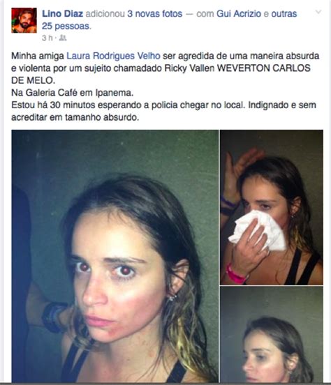 Cantor Brasileiro Acusado De Estapear F Em Boate Gay No Rio Guia