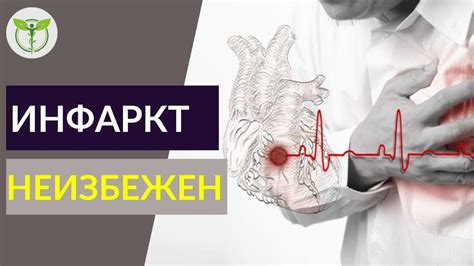 КАК ПОНЯТЬ, ЧТО СЕРДЦЕ ОСТАНАВЛИВАЕТСЯ - признаки инфаркта - YouTube