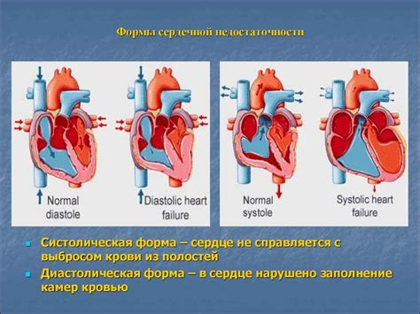 Нарушение кровообращения. Отеки - презентация онлайн