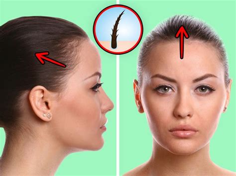 What Can Happen To Your Hair If You Wear Ponytails Way Too Often