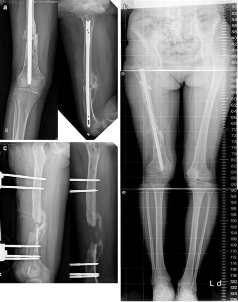 A Anteroposterior Lateral Radiographs And B Scanograph Of A Download Scientific Diagram